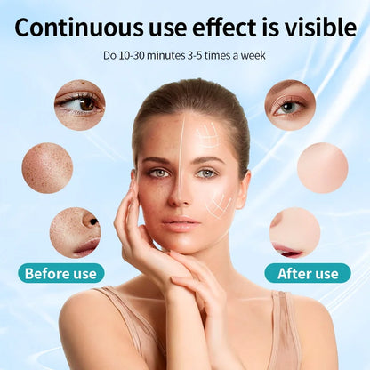MORAH™ RevitaLight 7-in-1 LED Therapy Mask